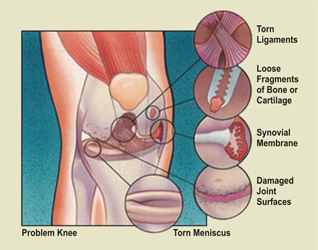 arthroscopy-treated-problem