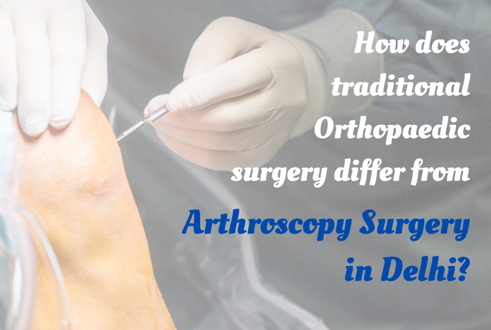 How does traditional Orthopaedic surgery differ from Arthroscopy Surgery in Delhi?