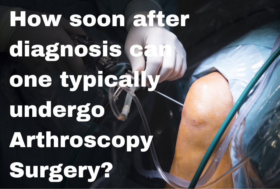 How soon after diagnosis can one typically undergo Arthroscopy Surgery?