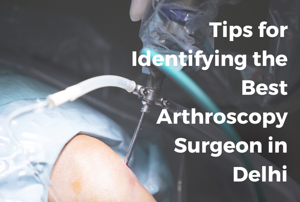 Tips for Identifying the Best Arthroscopy Surgeon in Delhi